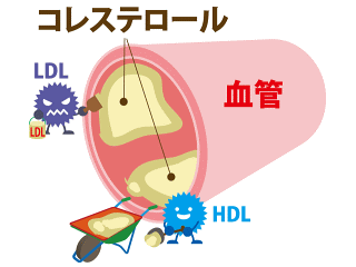 血管とコレステロールのイメージイラスト画像